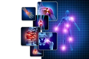 fibromiyalji nedir beslenme tadavisi nasıl olmalı